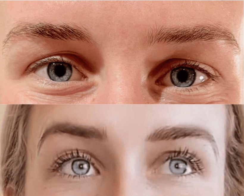 Brow Transformations, photo 1