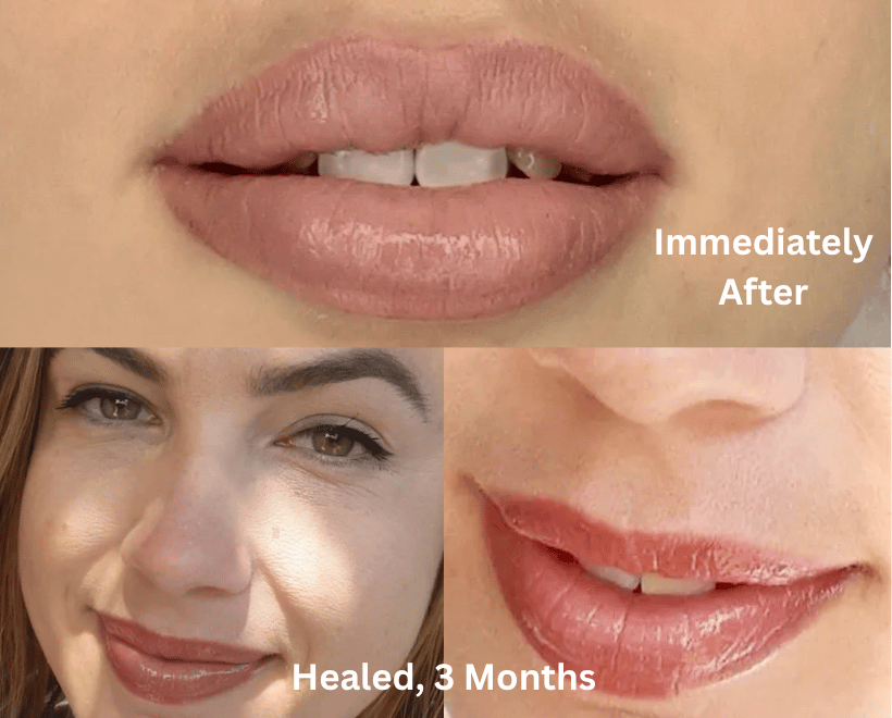 Lips Transformations, photo 1