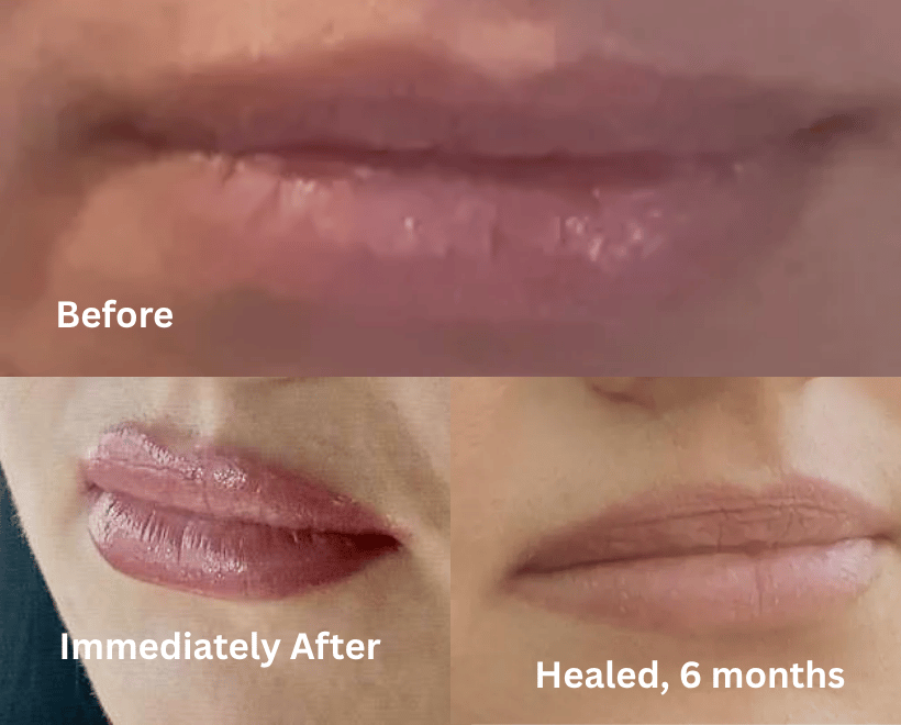 Lips Transformations, photo 4