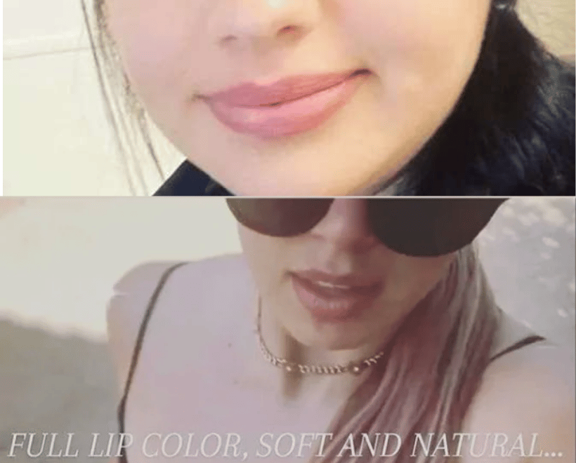 Lips Transformations, photo 5