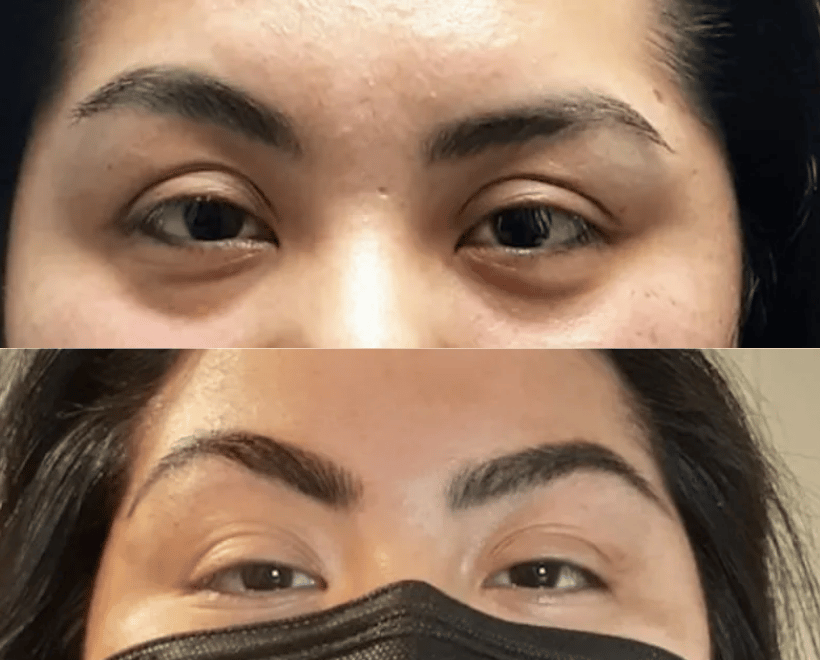 Brow Transformations, photo 4