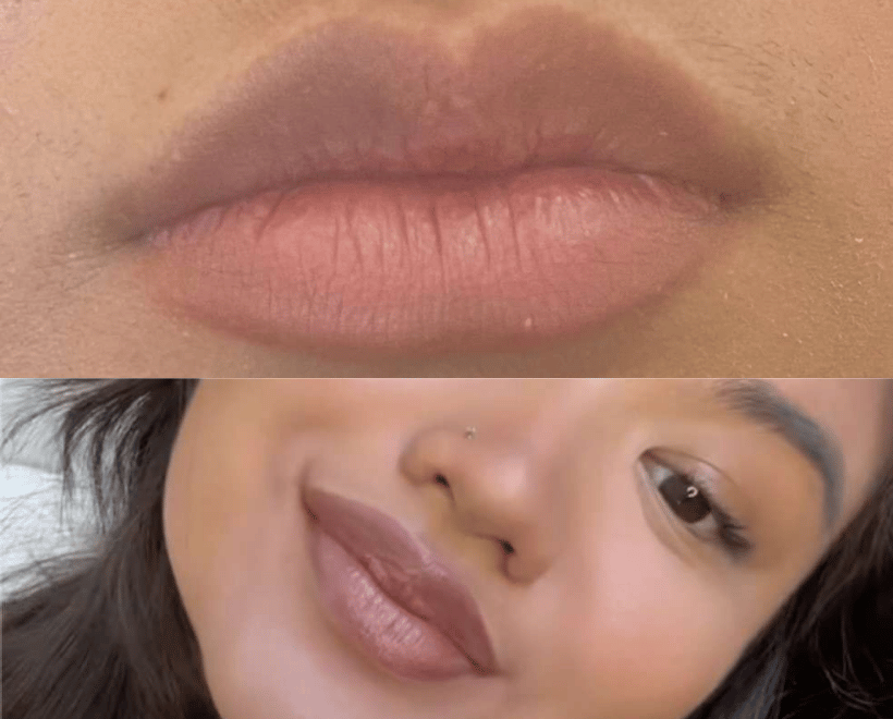 Lips Transformations, photo 2