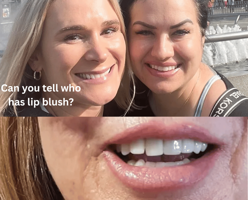 Lips Transformations, photo 6