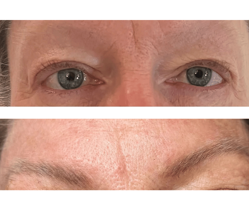 Brow Transformations, photo 16