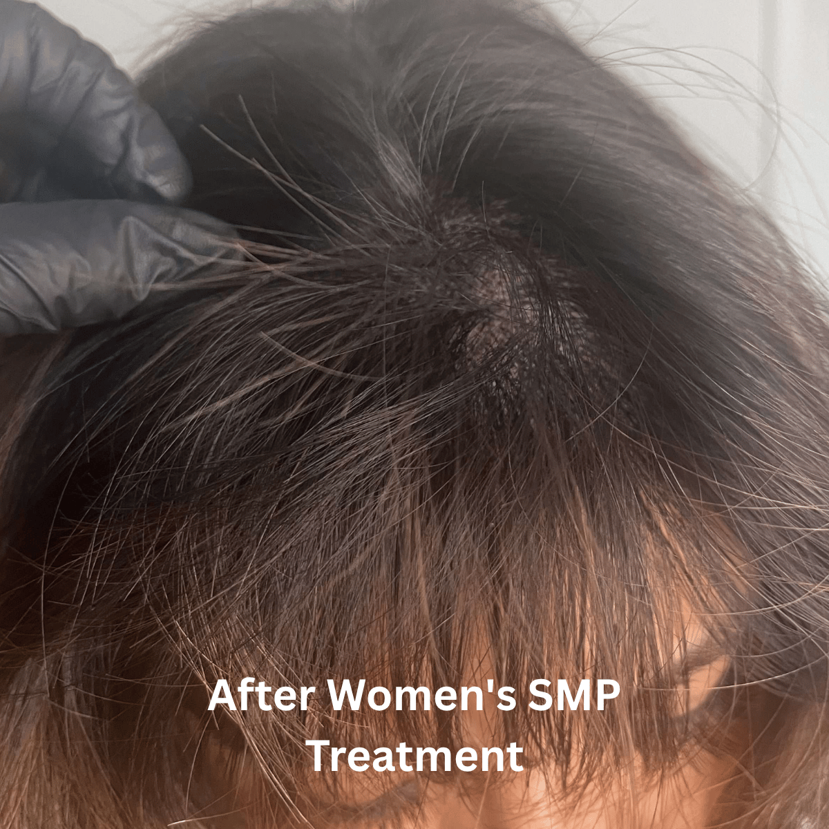 SMP for Women, photo 5