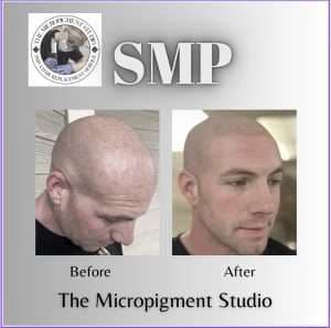 SMP Pricing
