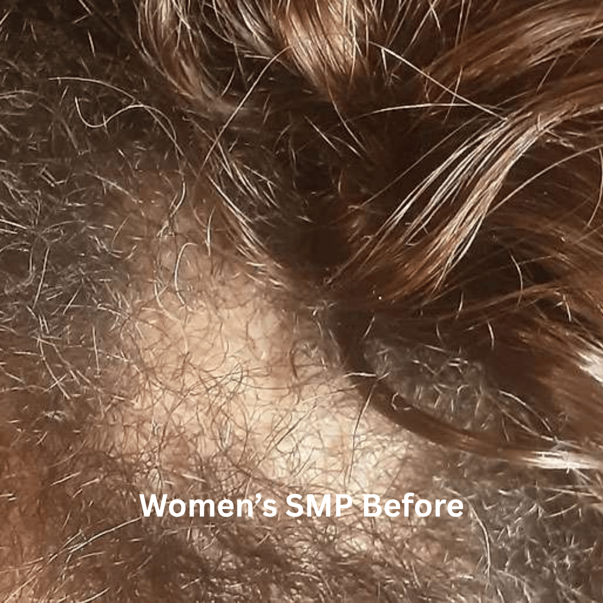 SMP for Women, photo 3