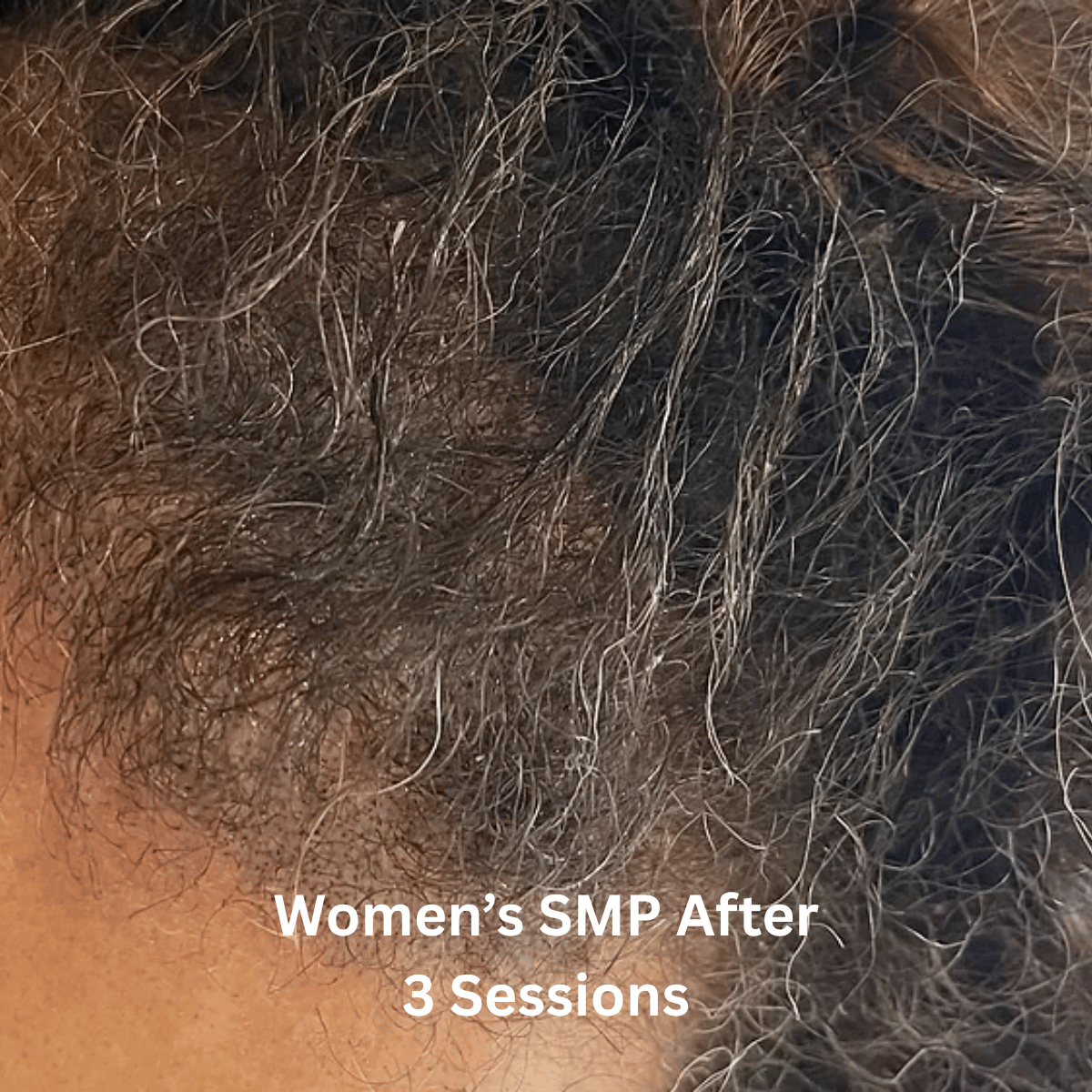 SMP for Women, photo 4