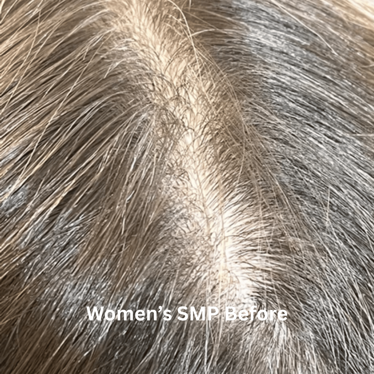 SMP for Women, photo 11