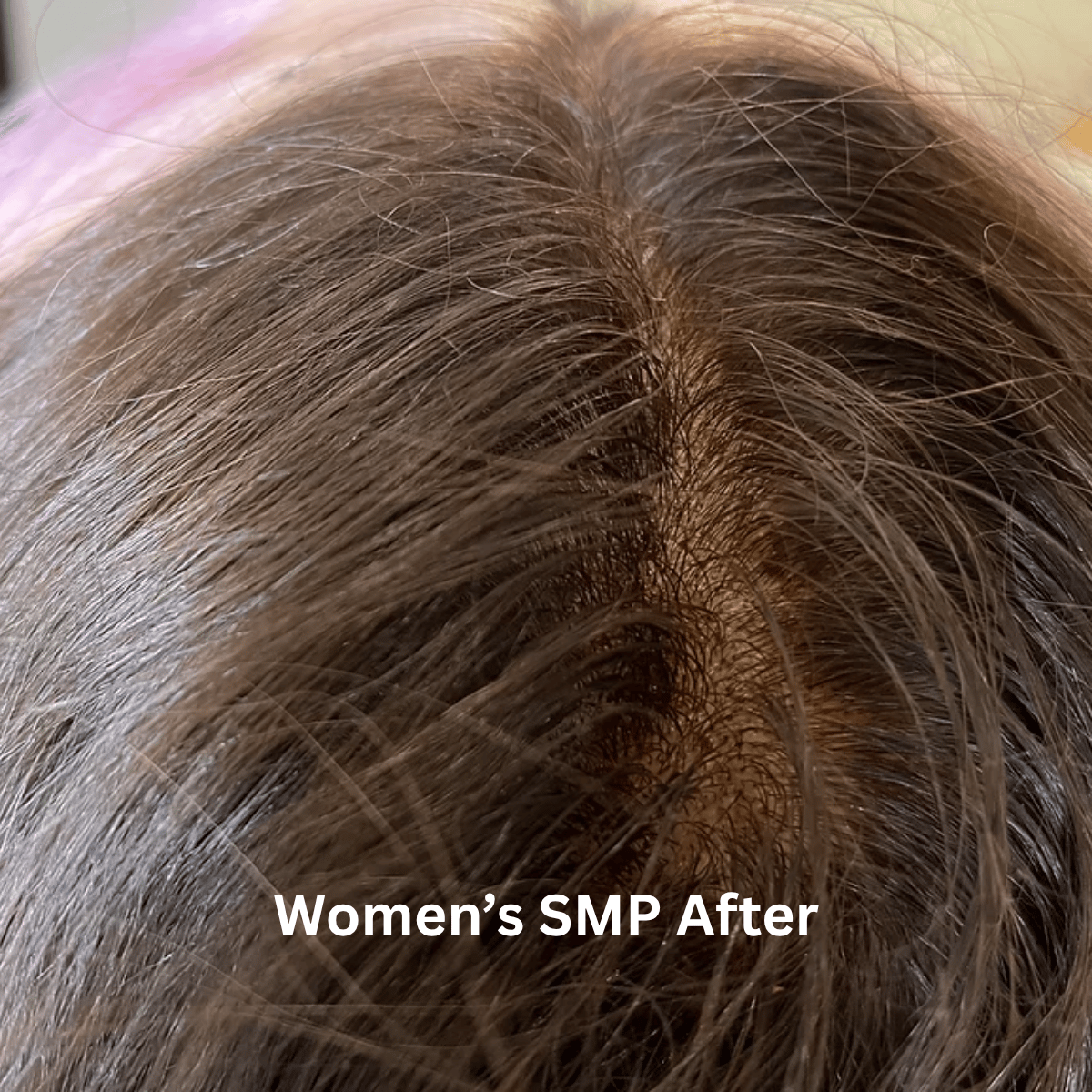 SMP for Women, photo 12