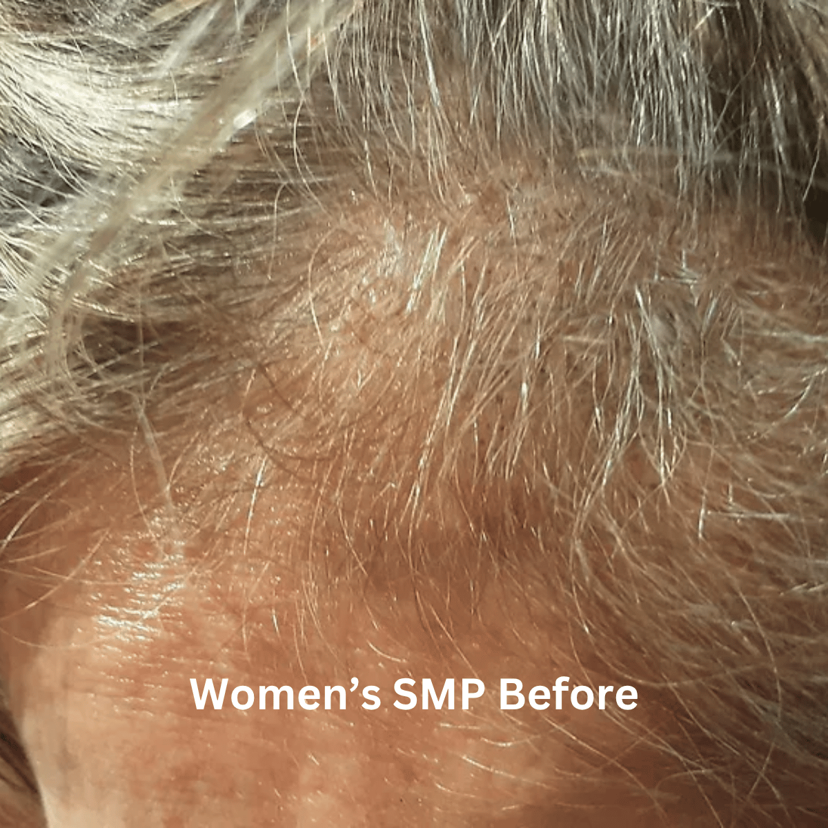 SMP for Women, photo 15