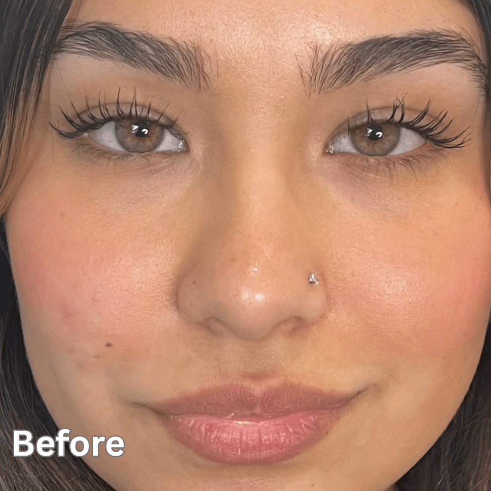 Permanent Lips