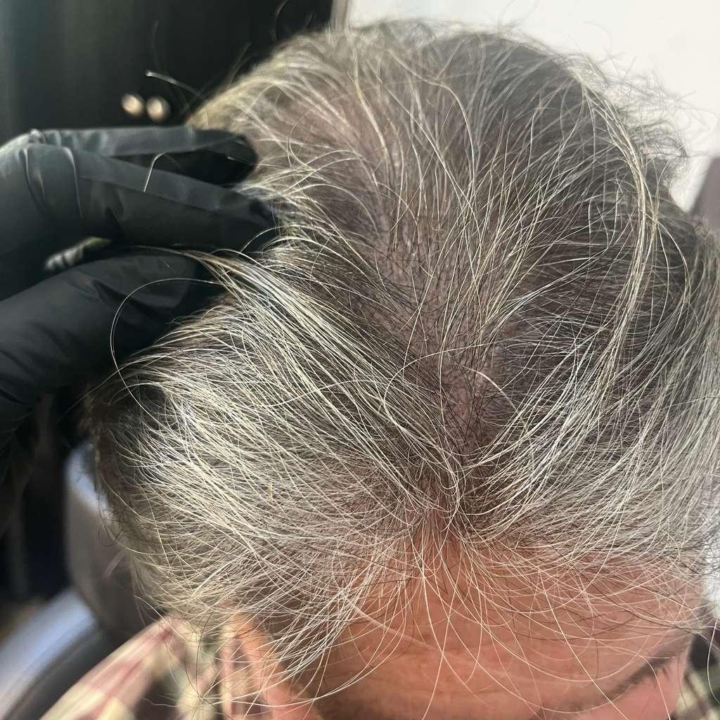 SMP density treatment, before & after
