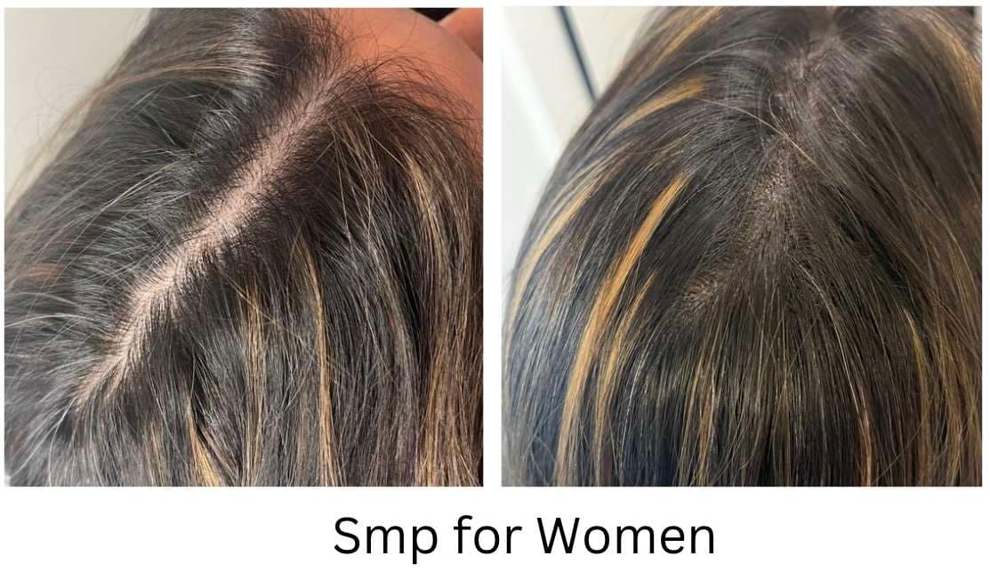 Step-by-Step: What Happens During an SMP Session?, photo 2