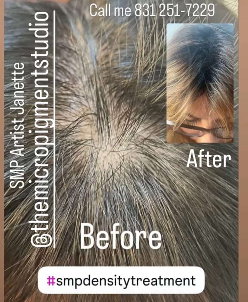 The History and Evolution of SMP: From Concept to Modern Treatment, photo 2