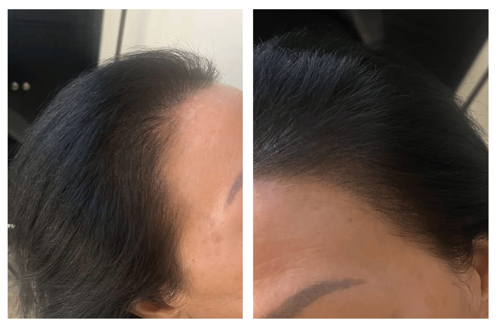 Women’s Hair Loss and the Emotional Toll Nobody Talks About Enough, photo 1