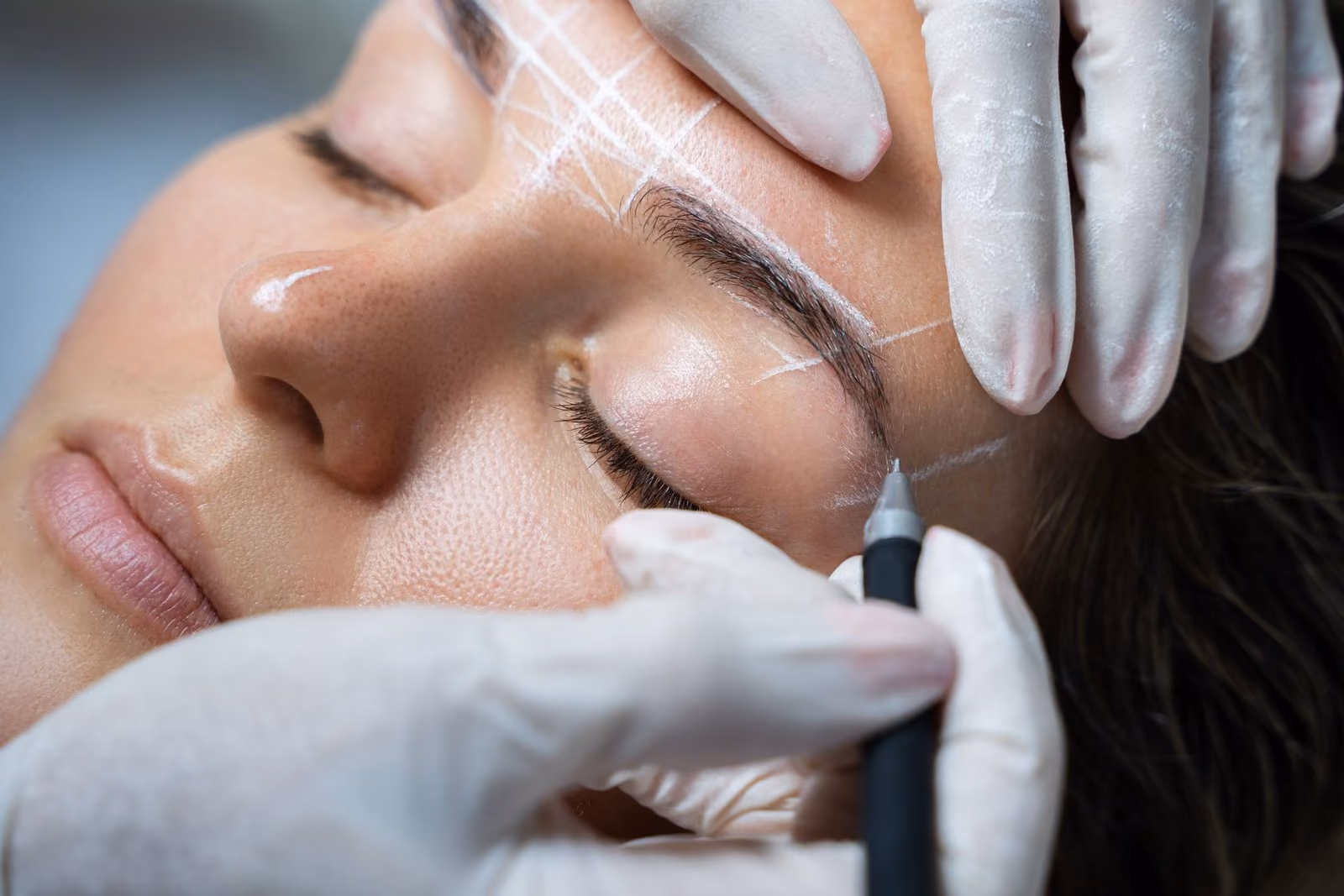 Close-up of a woman's face with white mapping lines drawn on her brow while gloved hands hold a pen-style tool