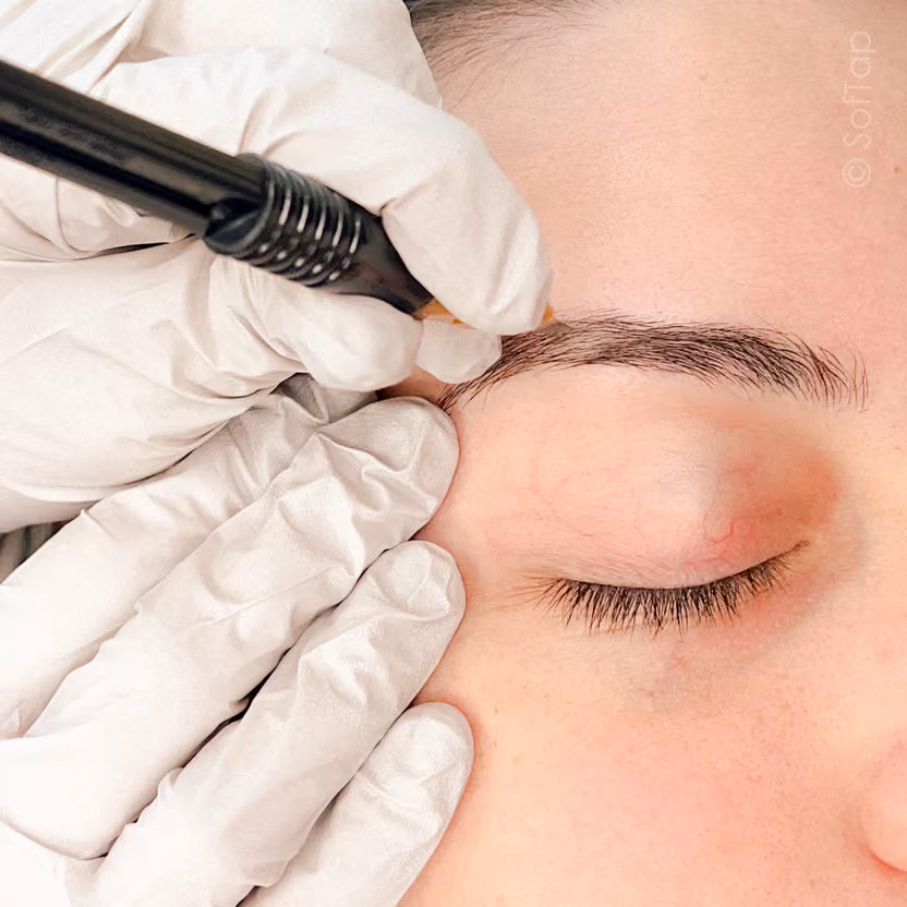 Gloved hands hold a pen-style SofTap brow device against a woman's eyebrow while her eye is closed