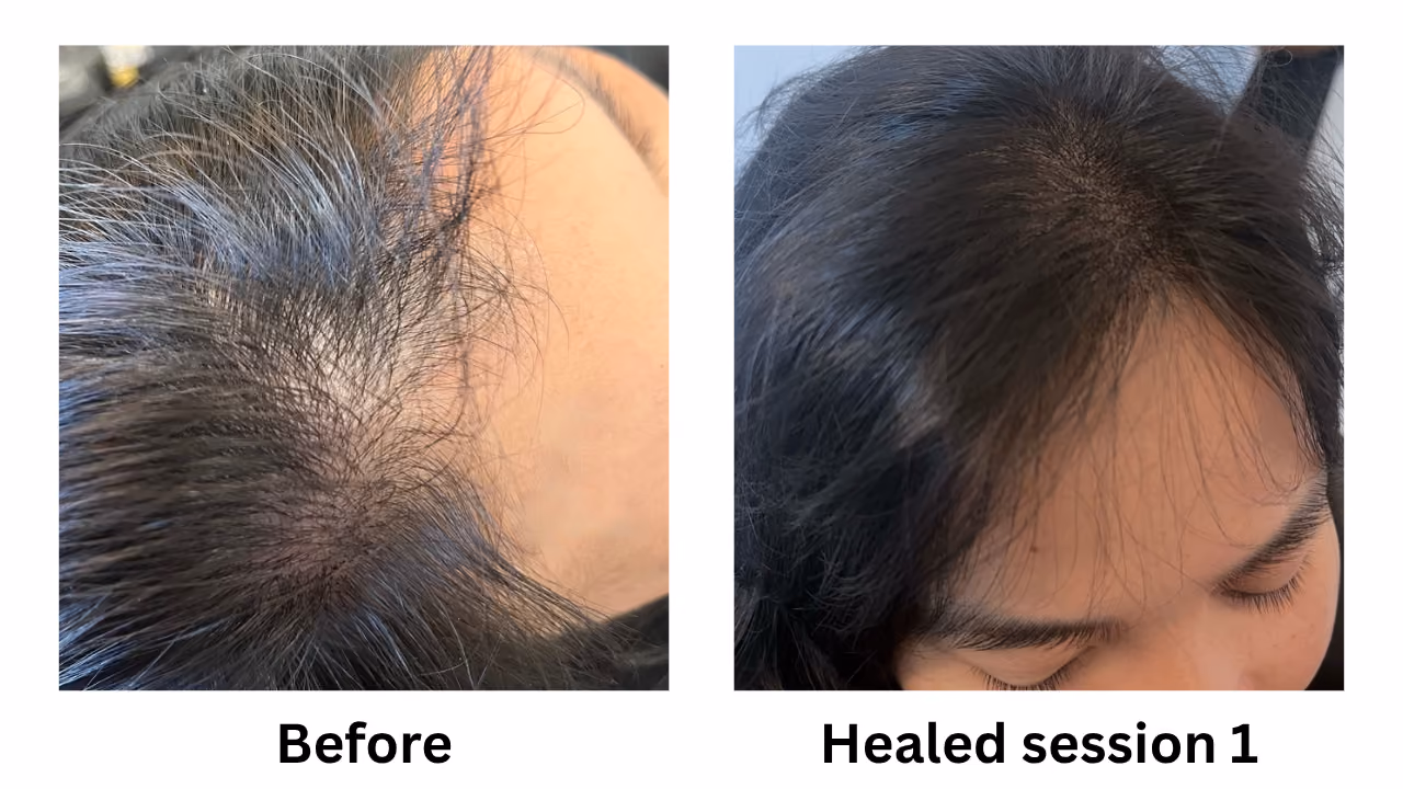 Side-by-side photos of a woman's dark hair parting, labeled Before and Healed session 1
