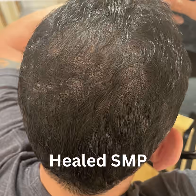 Top view of a man's short dark hair with healed scalp micropigmentation and a Healed SMP caption