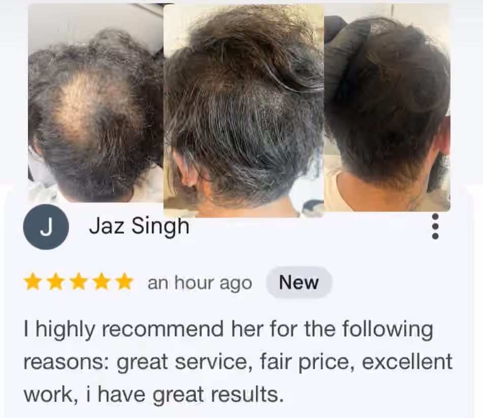 Screenshot of a five-star review with three photos of a man's scalp from above and behind