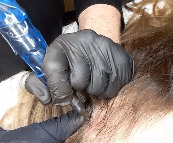 Gloved hands guiding a pigment needle on a scalp with reddish hair during an SMP session